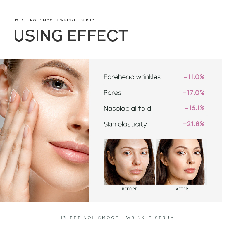 Suero Antiarrugas Quiyum con 1 - The Ordinary Serum Hyaluronic Acid reseña y precio